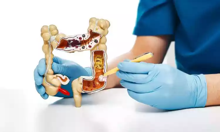 ilustracao do intestino mostrada por um medico 1 37082 Endic